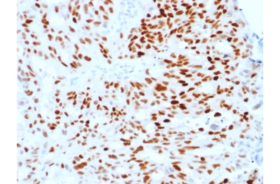 Immunohistochemistry (formalin-fixed, paraffin-embedded) - Anti-Estrogen Receptor alpha Antibody [ESR1/1904] (CF®488A) (A353645) - Antibodies.com