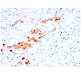 Immunohistochemistry (formalin-fixed, paraffin-embedded) - Anti-CD44v4 Antibody [rCD44v4/1219] (CF®594) (A353678) - Antibodies.com