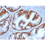 Immunohistochemistry (formalin-fixed, paraffin-embedded) - Anti-Estrogen Receptor alpha Antibody [ESR1/1935] (CF®640R) (A353681) - Antibodies.com
