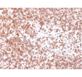 Immunohistochemistry (formalin-fixed, paraffin-embedded) - Anti-CD45 Antibody [PTPRC/1975R] (CF®594) (A353694) - Antibodies.com
