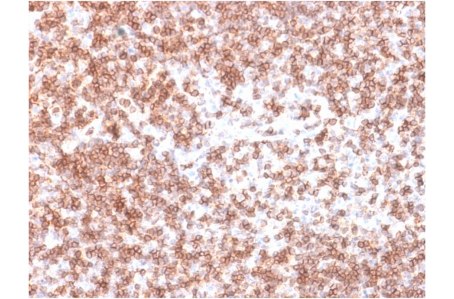 Immunohistochemistry (formalin-fixed, paraffin-embedded) - Anti-CD45 Antibody [PTPRC/1975R] (Biotin) (A353695) - Antibodies.com