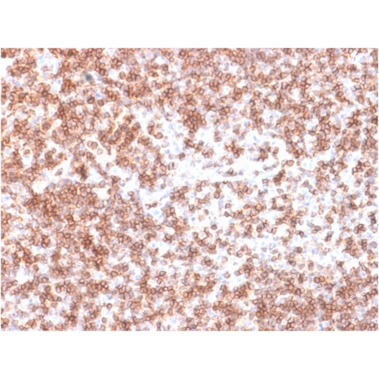 Immunohistochemistry (formalin-fixed, paraffin-embedded) - Anti-CD45 Antibody [PTPRC/1975R] (Biotin) (A353695) - Antibodies.com
