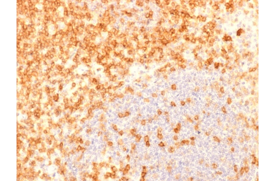 Immunohistochemistry (formalin-fixed, paraffin-embedded) - Anti-CD27 Antibody [rLPFS2/1611] (CF®405S) (A353696) - Antibodies.com