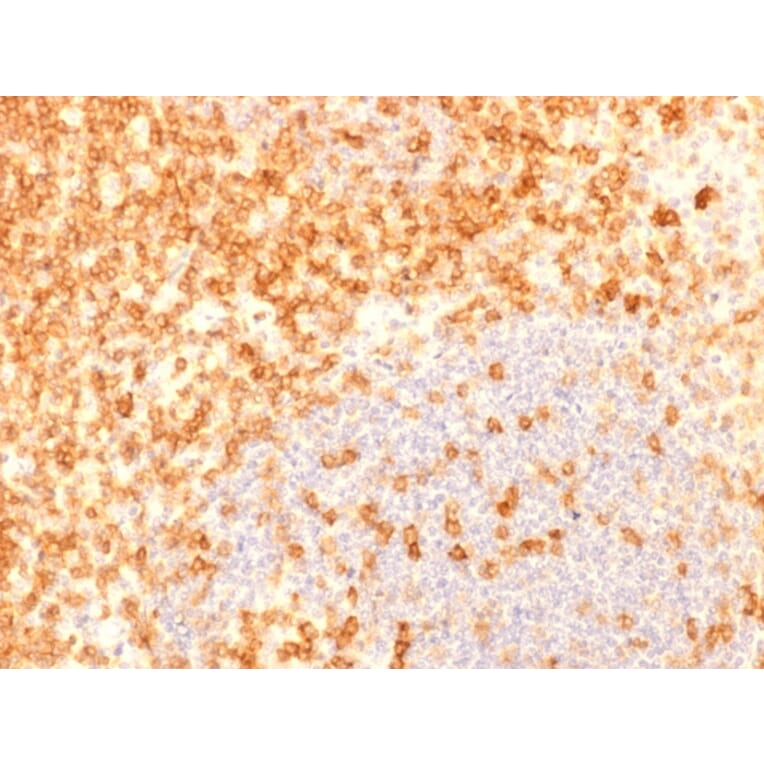 Immunohistochemistry (formalin-fixed, paraffin-embedded) - Anti-CD27 Antibody [rLPFS2/1611] (CF®640R) (A353697) - Antibodies.com