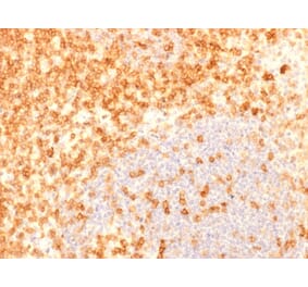 Immunohistochemistry (formalin-fixed, paraffin-embedded) - Anti-CD27 Antibody [rLPFS2/1611] (CF®740) (A353700) - Antibodies.com
