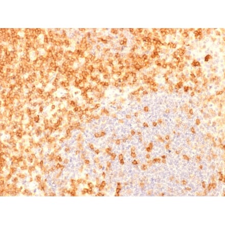 Immunohistochemistry (formalin-fixed, paraffin-embedded) - Anti-CD27 Antibody [rLPFS2/1611] (CF®740) (A353700) - Antibodies.com
