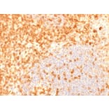 Immunohistochemistry (formalin-fixed, paraffin-embedded) - Anti-CD27 Antibody [rLPFS2/1611] (CF®488A) (A353701) - Antibodies.com
