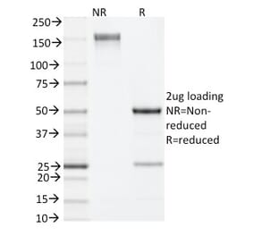 SDS-PAGE - Anti-IL-4 Antibody [11B11] (Biotin) (A353727) - Antibodies.com