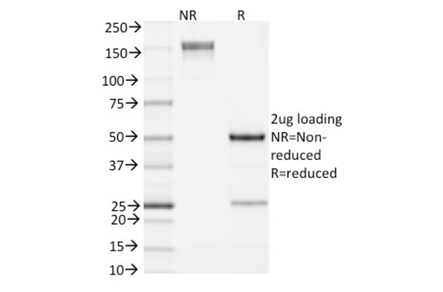 SDS-PAGE - Anti-IL-4 Antibody [11B11] (Biotin) (A353727) - Antibodies.com