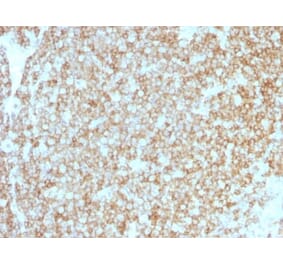 Immunohistochemistry (formalin-fixed, paraffin-embedded) - Anti-CD45 Antibody [PTPRC/1783R + PTPRC/1975R] (CF®640R) (A353741) - Antibodies.com