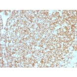 Immunohistochemistry (formalin-fixed, paraffin-embedded) - Anti-CD45 Antibody [PTPRC/1783R + PTPRC/1975R] (CF®640R) (A353741) - Antibodies.com