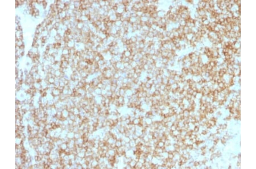 Immunohistochemistry (formalin-fixed, paraffin-embedded) - Anti-CD45 Antibody [PTPRC/1783R + PTPRC/1975R] (CF®488A) (A353745) - Antibodies.com