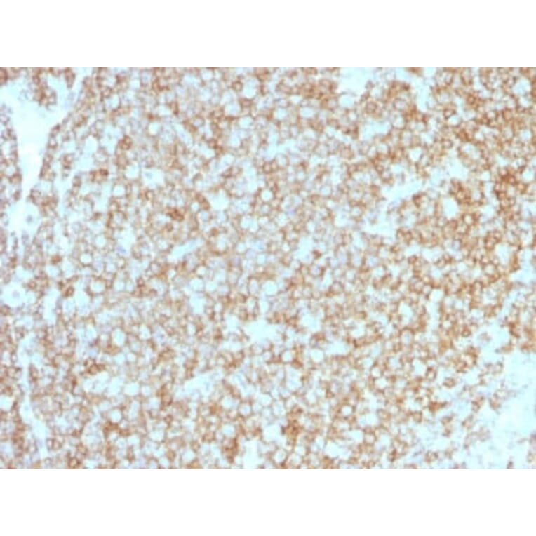 Immunohistochemistry (formalin-fixed, paraffin-embedded) - Anti-CD45 Antibody [PTPRC/1783R + PTPRC/1975R] (CF®594) (A353746) - Antibodies.com