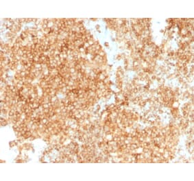 Immunohistochemistry (formalin-fixed, paraffin-embedded) - Anti-CD45 Antibody [PTPRC/1147 + PTPRC/1460] (CF®568) (A353751) - Antibodies.com