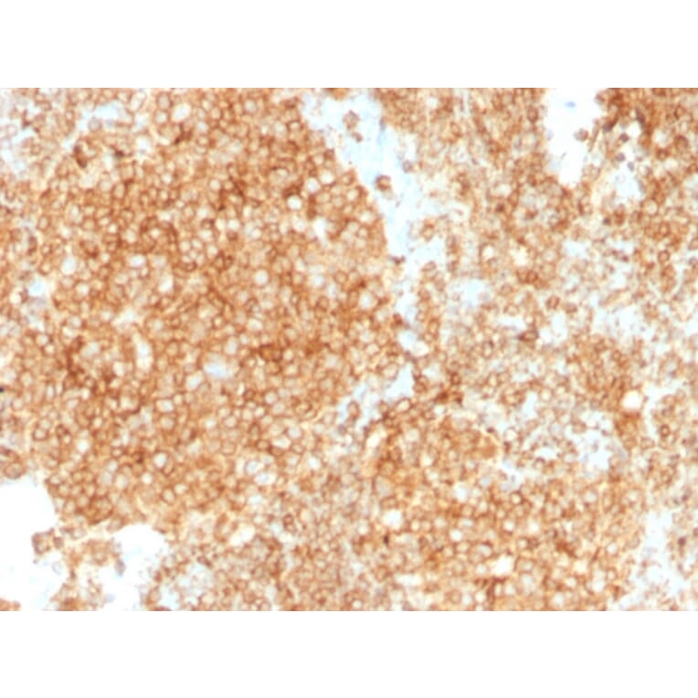 Immunohistochemistry (formalin-fixed, paraffin-embedded) - Anti-CD45 Antibody [PTPRC/1147 + PTPRC/1460] (CF®594) (A353754) - Antibodies.com