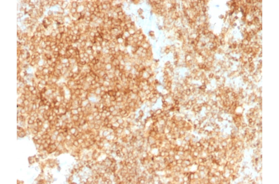 Immunohistochemistry (formalin-fixed, paraffin-embedded) - Anti-CD45 Antibody [PTPRC/1147 + PTPRC/1460] (Biotin) (A353755) - Antibodies.com