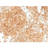 Immunohistochemistry (formalin-fixed, paraffin-embedded) - Anti-CD45 Antibody [PTPRC/1147 + PTPRC/1460] (Biotin) (A353755) - Antibodies.com