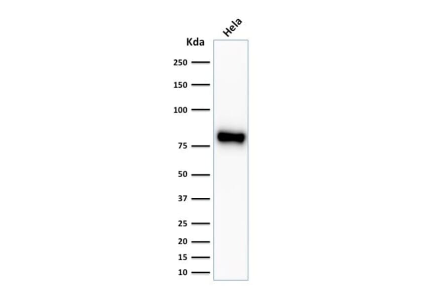 Wstern Blot - Anti-beta Catenin Antibody [CTNNB1/2030R] (CF®405S) (A353756) - Antibodies.com