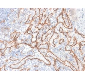 Immunohistochemistry (formalin-fixed, paraffin-embedded) - Anti-beta Catenin Antibody [CTNNB1/2030R] (CF®647) (A353758) - Antibodies.com