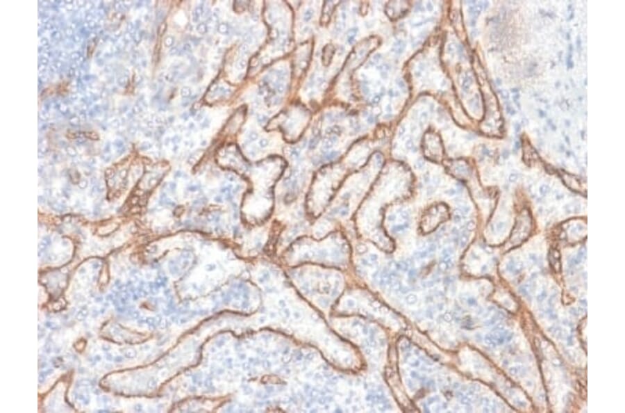 Immunohistochemistry (formalin-fixed, paraffin-embedded) - Anti-beta Catenin Antibody [CTNNB1/2030R] (CF®647) (A353758) - Antibodies.com
