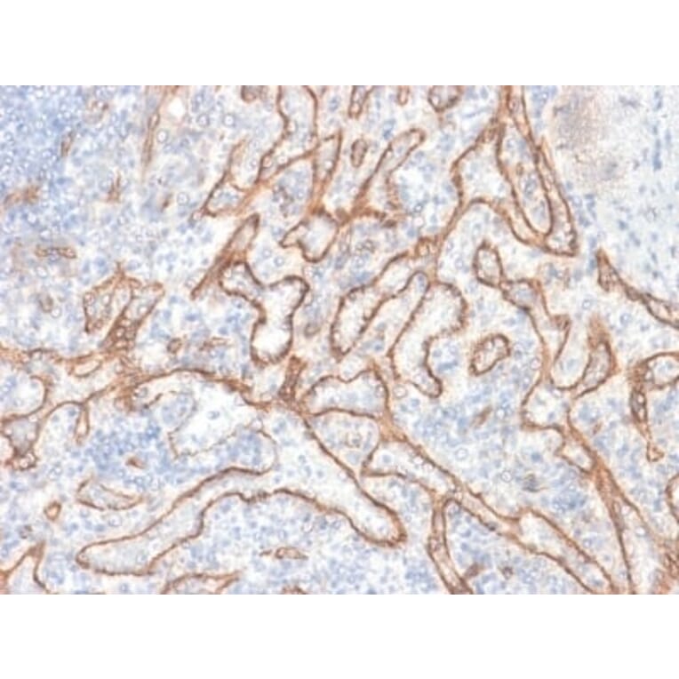 Immunohistochemistry (formalin-fixed, paraffin-embedded) - Anti-beta Catenin Antibody [CTNNB1/2030R] (CF®647) (A353758) - Antibodies.com