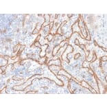 Immunohistochemistry (formalin-fixed, paraffin-embedded) - Anti-beta Catenin Antibody [CTNNB1/2030R] (CF®647) (A353758) - Antibodies.com