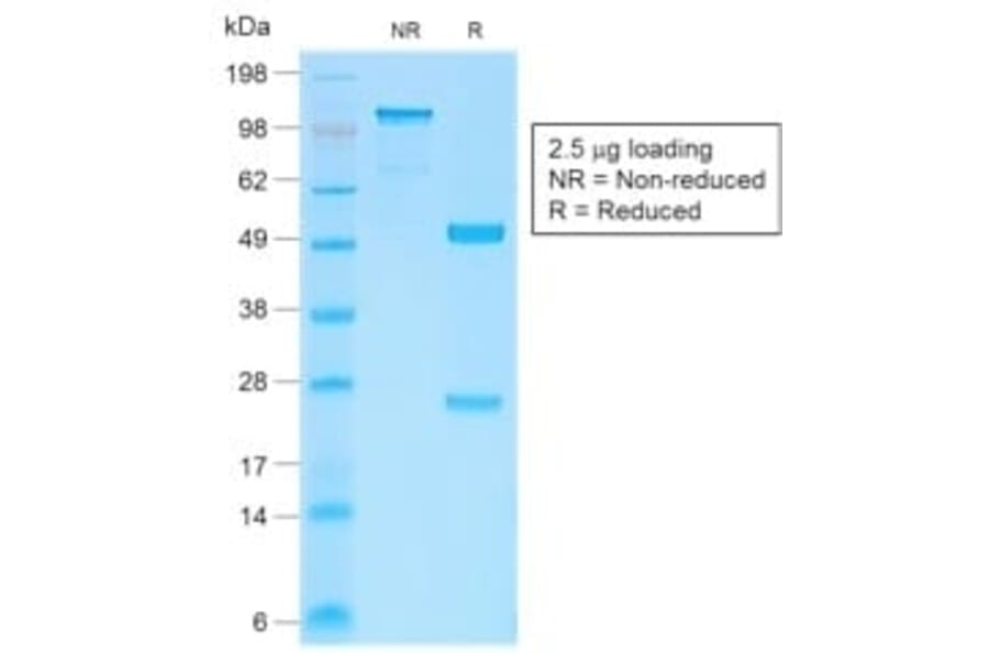 SDS-PAGE - Anti-beta Catenin Antibody [CTNNB1/2030R] (CF®647) (A353758) - Antibodies.com