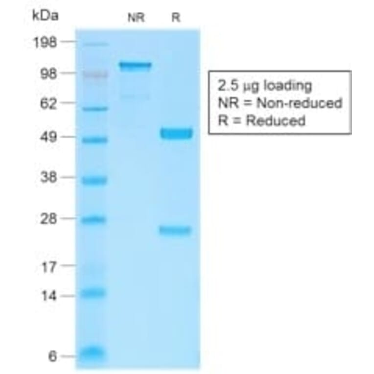 SDS-PAGE - Anti-beta Catenin Antibody [CTNNB1/2030R] (CF®647) (A353758) - Antibodies.com