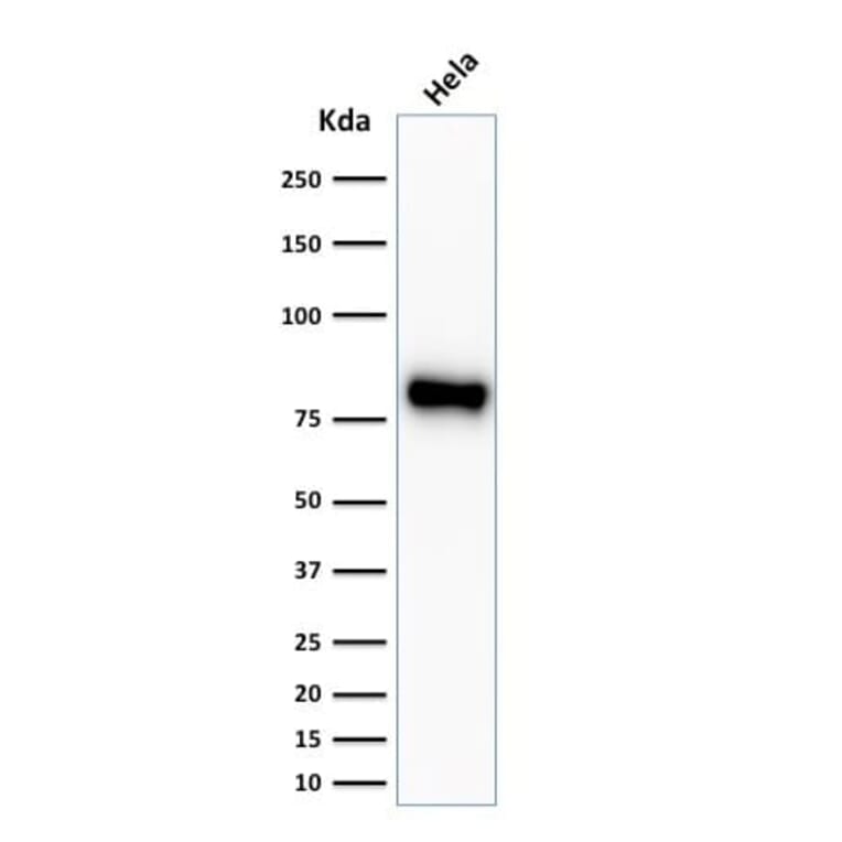 Wstern Blot - Anti-beta Catenin Antibody [CTNNB1/2030R] (CF®740) (A353760) - Antibodies.com