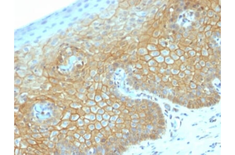 Immunohistochemistry (formalin-fixed, paraffin-embedded) - Anti-beta Catenin Antibody [CTNNB1/2030R] (CF®488A) (A353761) - Antibodies.com