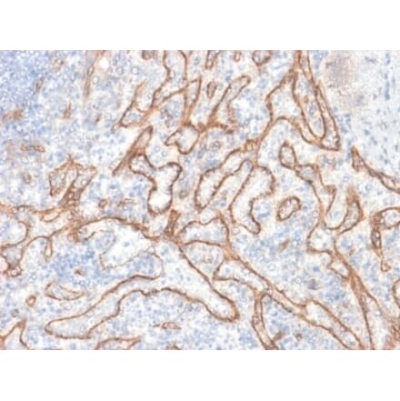 Immunohistochemistry (formalin-fixed, paraffin-embedded) - Anti-beta Catenin Antibody [CTNNB1/2030R] (Biotin) (A353763) - Antibodies.com