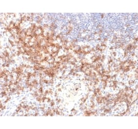 Immunohistochemistry (formalin-fixed, paraffin-embedded) - Anti-CD27 Antibody [LPFS2/2034R] (CF®405S) (A353764) - Antibodies.com