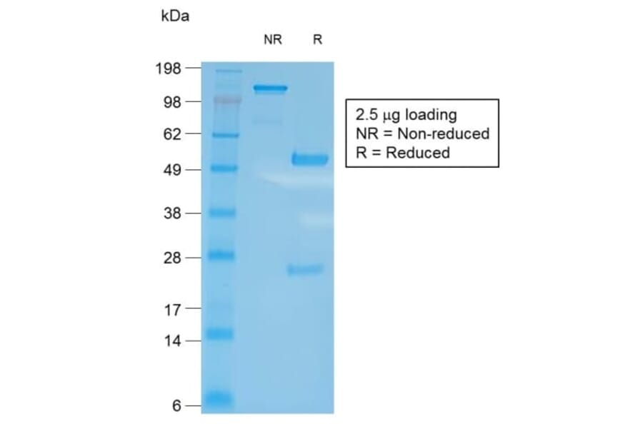 SDS-PAGE - Anti-CD27 Antibody [LPFS2/2034R] (CF®405S) (A353764) - Antibodies.com