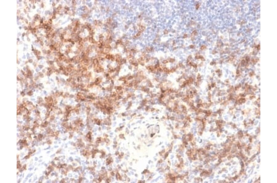Immunohistochemistry (formalin-fixed, paraffin-embedded) - Anti-CD27 Antibody [LPFS2/2034R] (CF®647) (A353766) - Antibodies.com