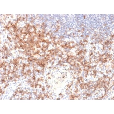 Immunohistochemistry (formalin-fixed, paraffin-embedded) - Anti-CD27 Antibody [LPFS2/2034R] (CF®740) (A353768) - Antibodies.com