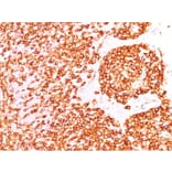 Immunohistochemistry (formalin-fixed, paraffin-embedded) - Anti-CD45 Antibody [rPTPRC/1460] (CF®640R) (A353774) - Antibodies.com