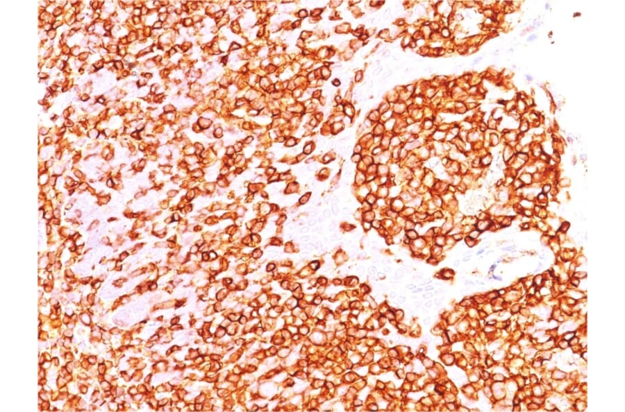 Immunohistochemistry (formalin-fixed, paraffin-embedded) - Anti-CD45 Antibody [rPTPRC/1460] (CF®488A) (A353778) - Antibodies.com