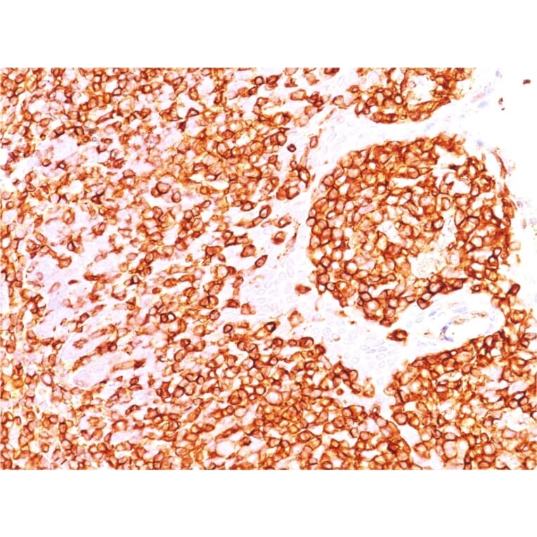 Immunohistochemistry (formalin-fixed, paraffin-embedded) - Anti-CD45 Antibody [rPTPRC/1460] (CF®488A) (A353778) - Antibodies.com