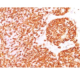 Immunohistochemistry (formalin-fixed, paraffin-embedded) - Anti-CD45 Antibody [rPTPRC/1460] (Biotin) (A353780) - Antibodies.com