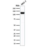 Wstern Blot - Anti-E-Cadherin Antibody [rCDH1/1525] (CF®405S) (A353781) - Antibodies.com