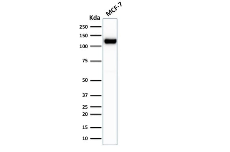Wstern Blot - Anti-E-Cadherin Antibody [rCDH1/1525] (CF®640R) (A353782) - Antibodies.com