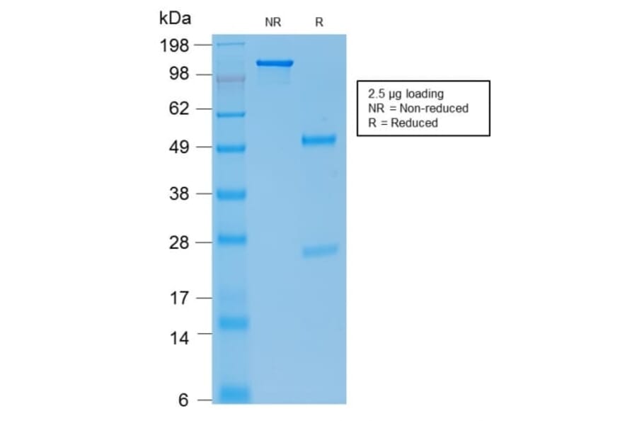 SDS-PAGE - Anti-E-Cadherin Antibody [rCDH1/1525] (CF®640R) (A353782) - Antibodies.com