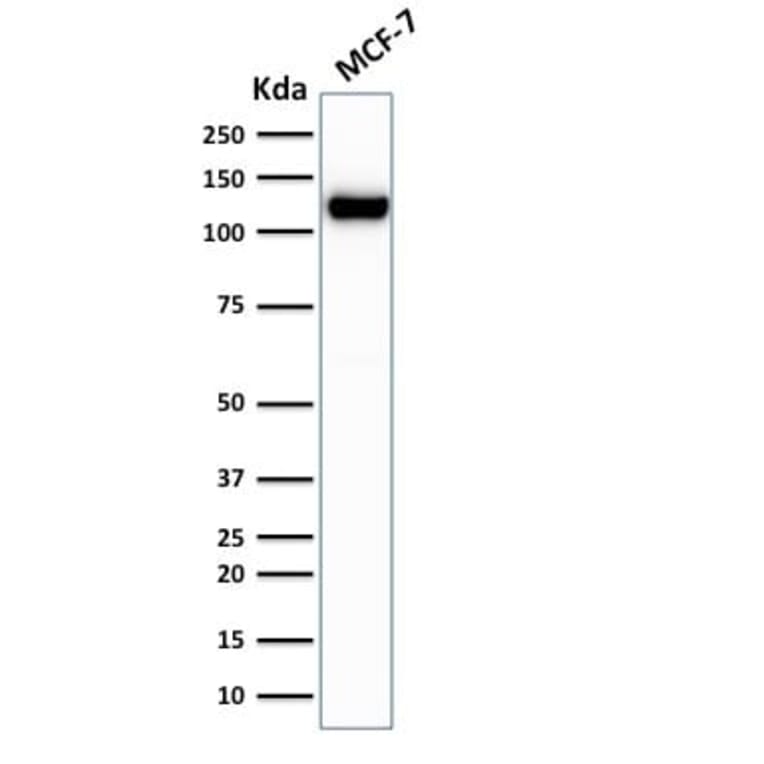 Wstern Blot - Anti-E-Cadherin Antibody [rCDH1/1525] (CF®647) (A353783) - Antibodies.com