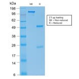 SDS-PAGE - Anti-E-Cadherin Antibody [rCDH1/1525] (CF®568) (A353784) - Antibodies.com