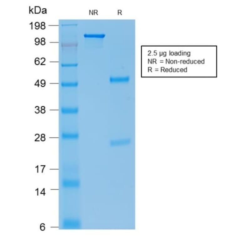 SDS-PAGE - Anti-E-Cadherin Antibody [rCDH1/1525] (CF®488A) (A353786) - Antibodies.com