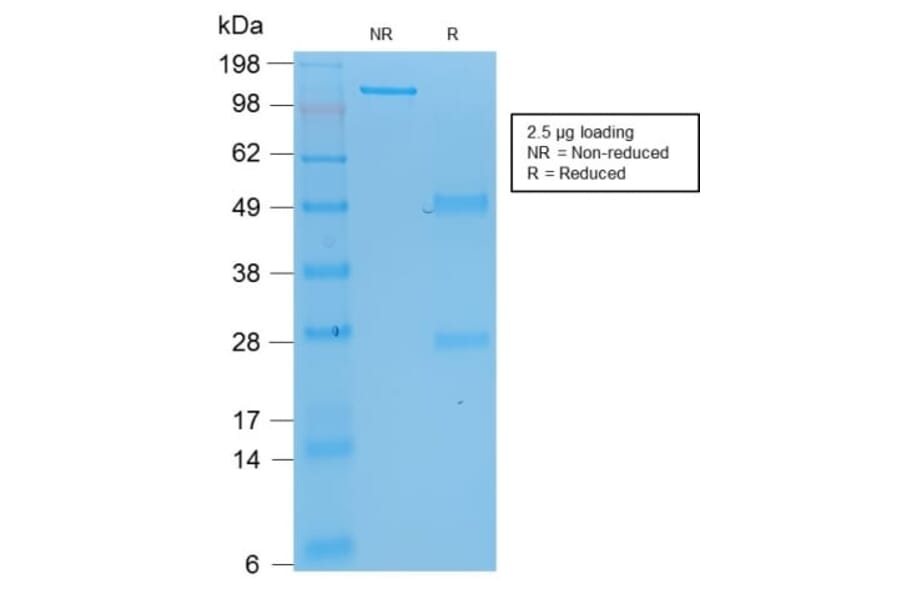 SDS-PAGE - Anti-p53 Antibody [rBP53-12] (CF®488A) (A353810) - Antibodies.com