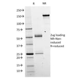 SDS-PAGE - Anti-beta Catenin Antibody [CTNNB1/2098] (CF®405S) (A353813) - Antibodies.com