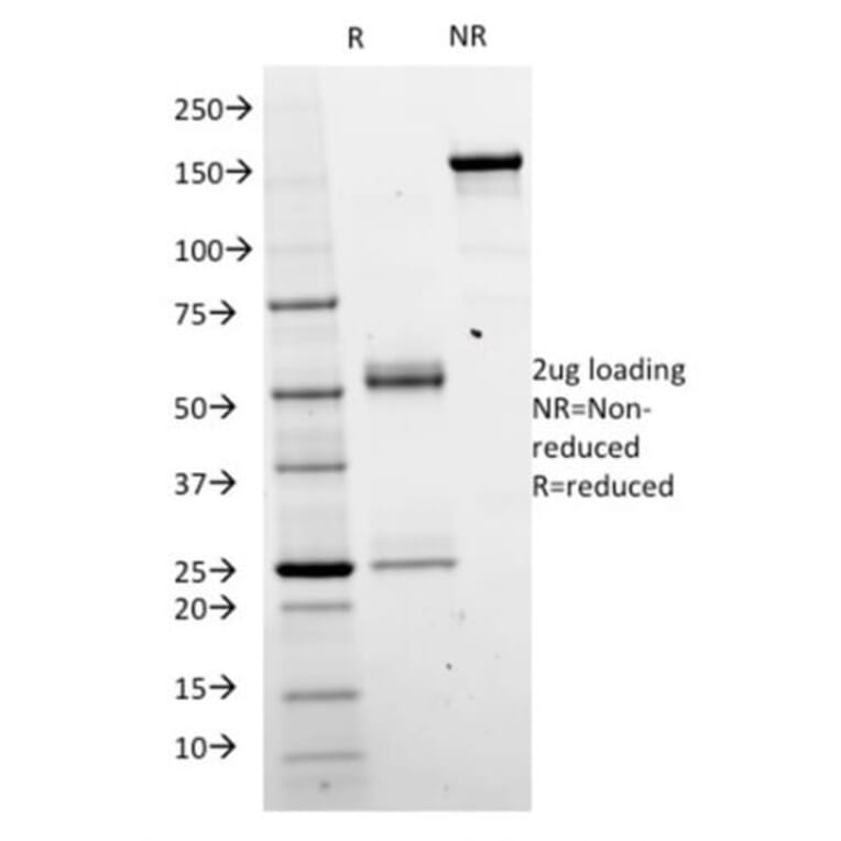 SDS-PAGE - Anti-beta Catenin Antibody [CTNNB1/2098] (CF®640R) (A353814) - Antibodies.com