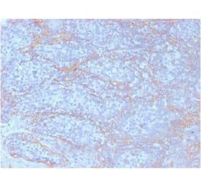 Immunohistochemistry (formalin-fixed, paraffin-embedded) - Anti-beta Catenin Antibody [CTNNB1/2098] (CF®647) (A353815) - Antibodies.com