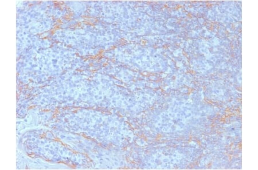 Immunohistochemistry (formalin-fixed, paraffin-embedded) - Anti-beta Catenin Antibody [CTNNB1/2098] (CF®647) (A353815) - Antibodies.com